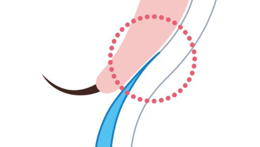 FP Edge profile