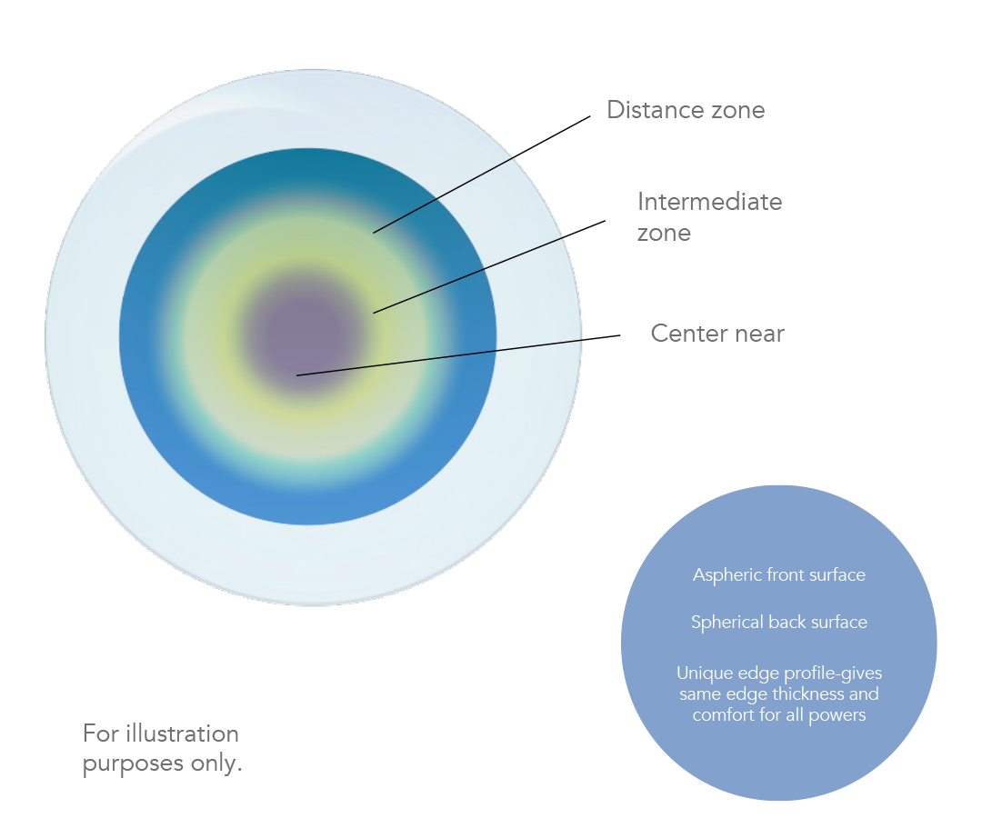 Upside Multifocal diagram